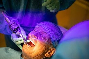 Dental Implants Stuart