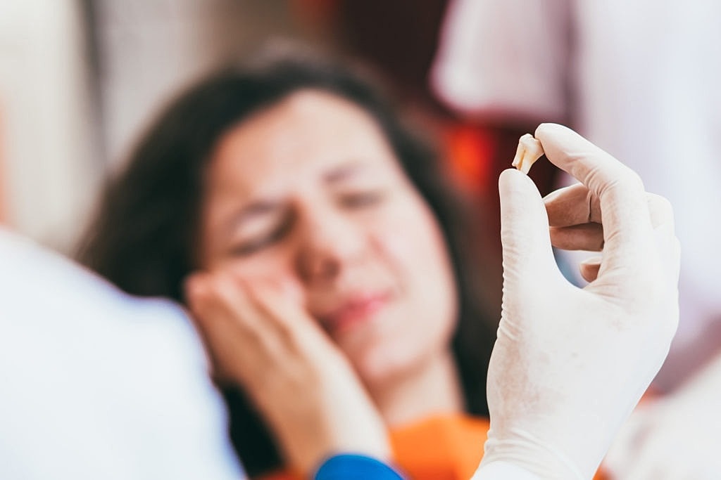 Common Reasons for a Tooth Extraction