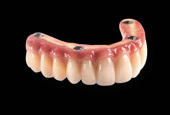 Dental prosthesis on a black background.