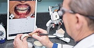 Dental technician working on dental models.