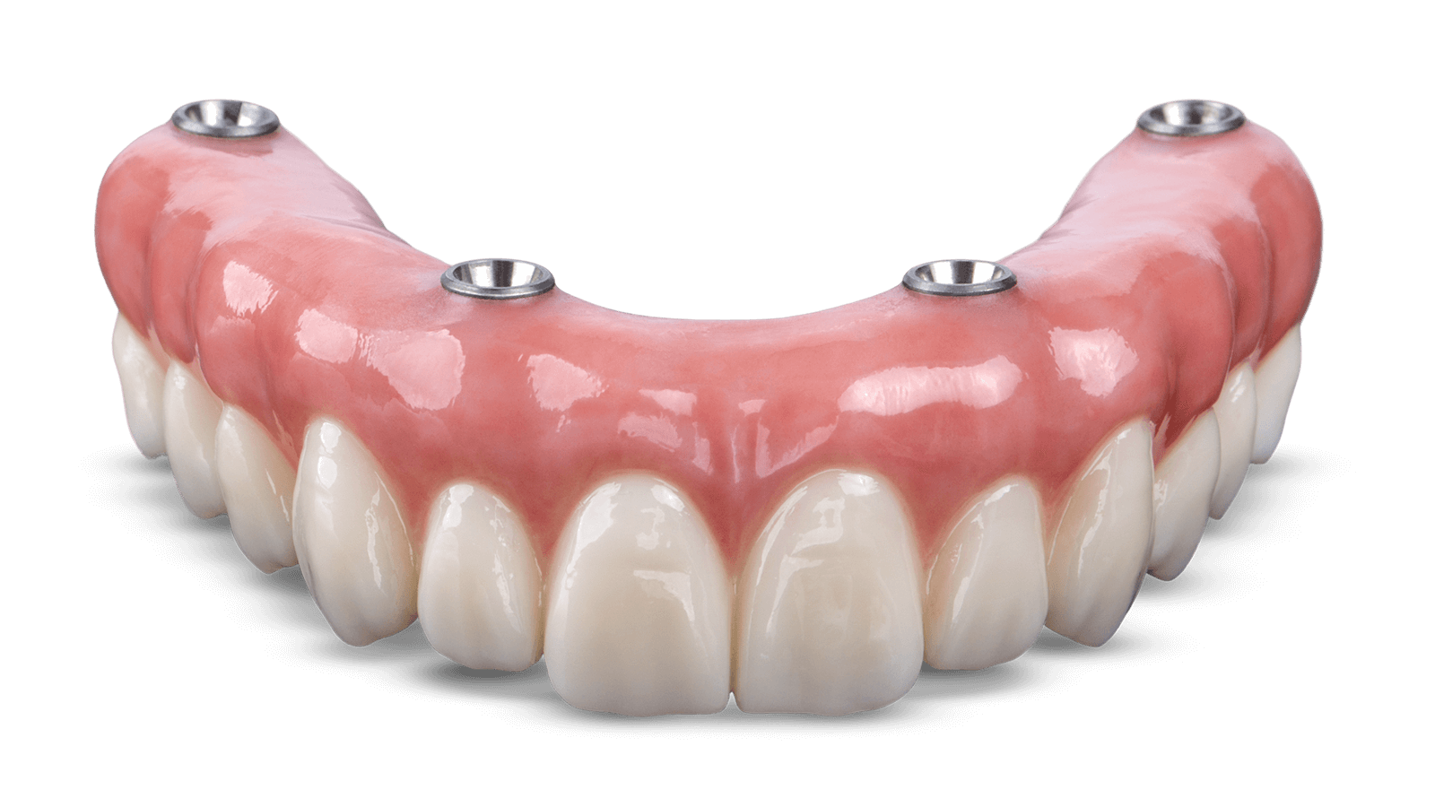 NobelProcera® implant dentures